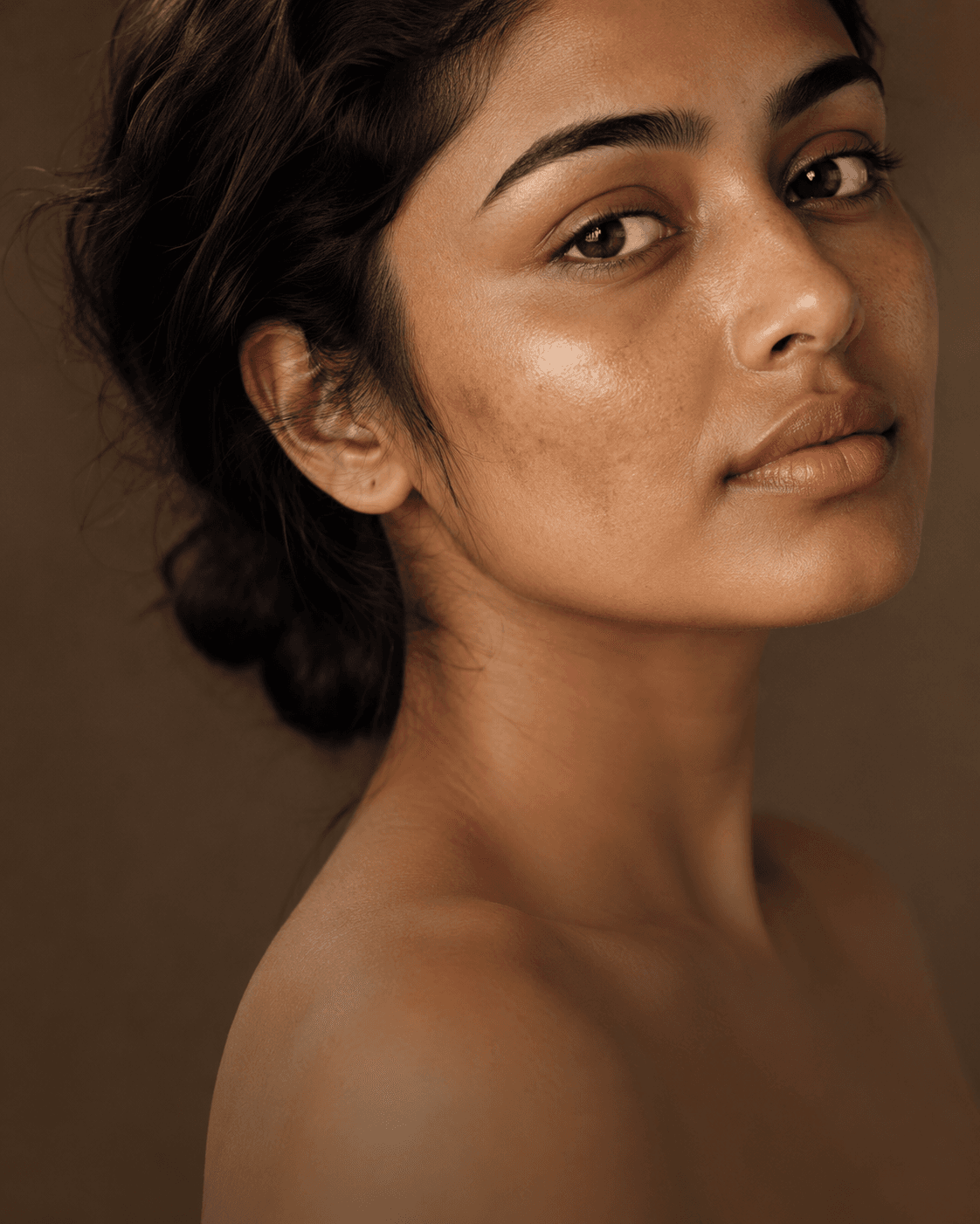Dark Spots & Pigmentation